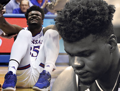 Удока повредил лодыжку.